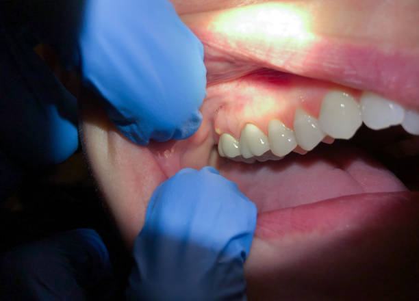 Best Mobile Emergency Dentist in Mullica Hill, NJ
