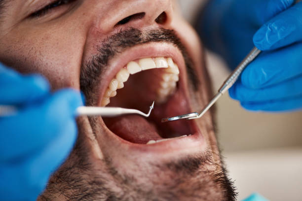 Best Mobile Emergency Dentist in Mullica Hill, NJ
